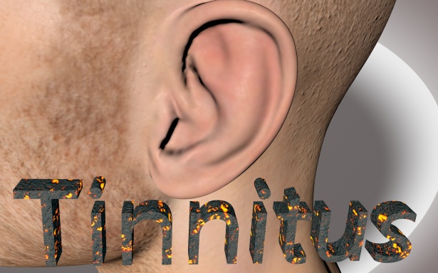 tinnitus